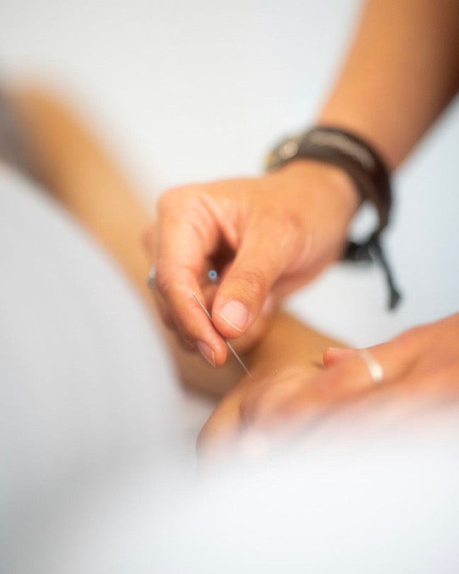 Private Acupuncture