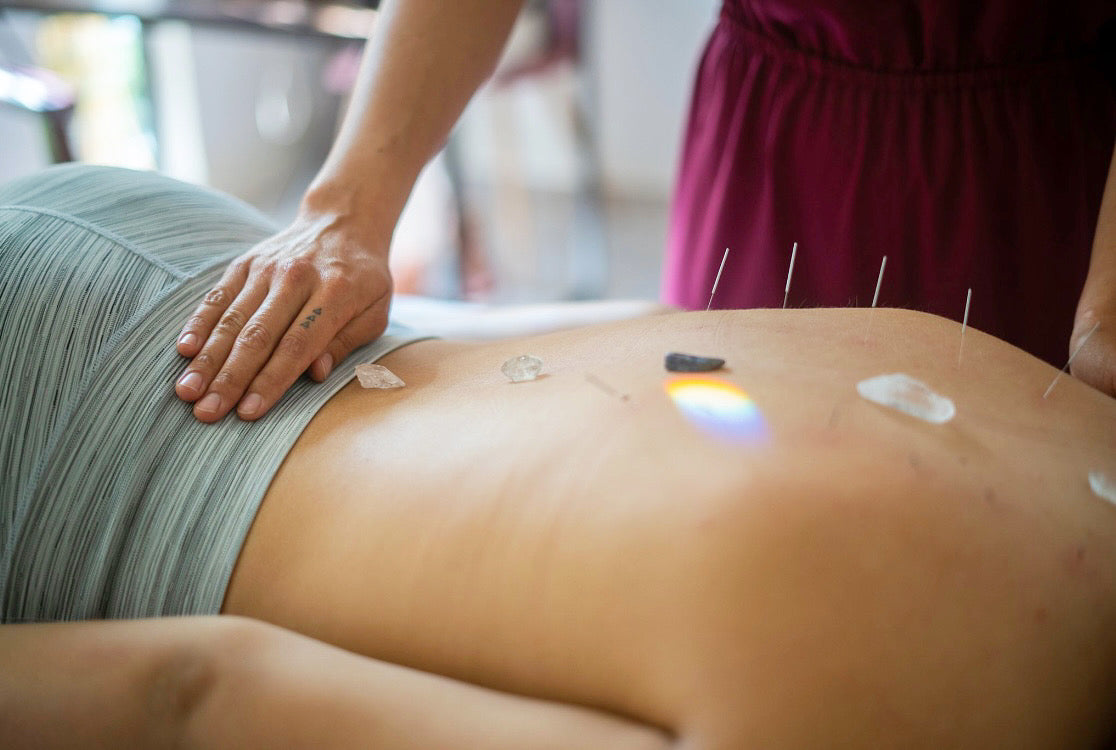 Private Acupuncture