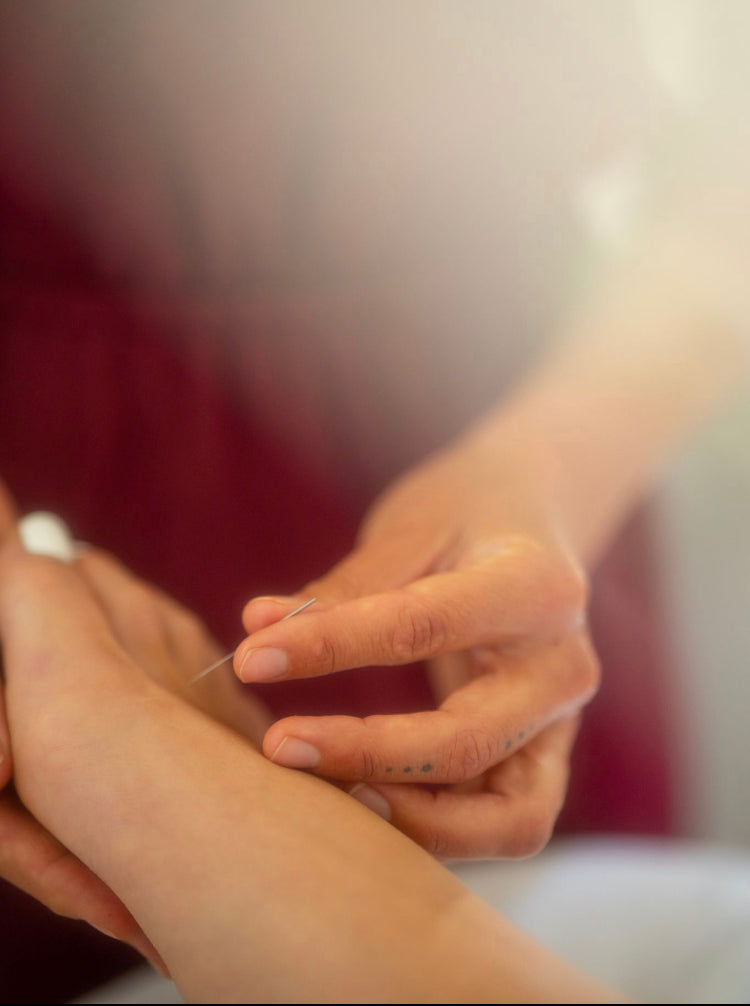 Private Acupuncture