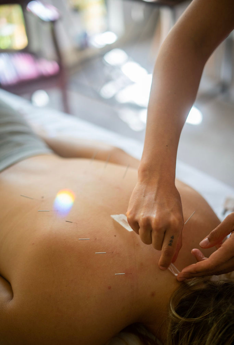 Private Acupuncture
