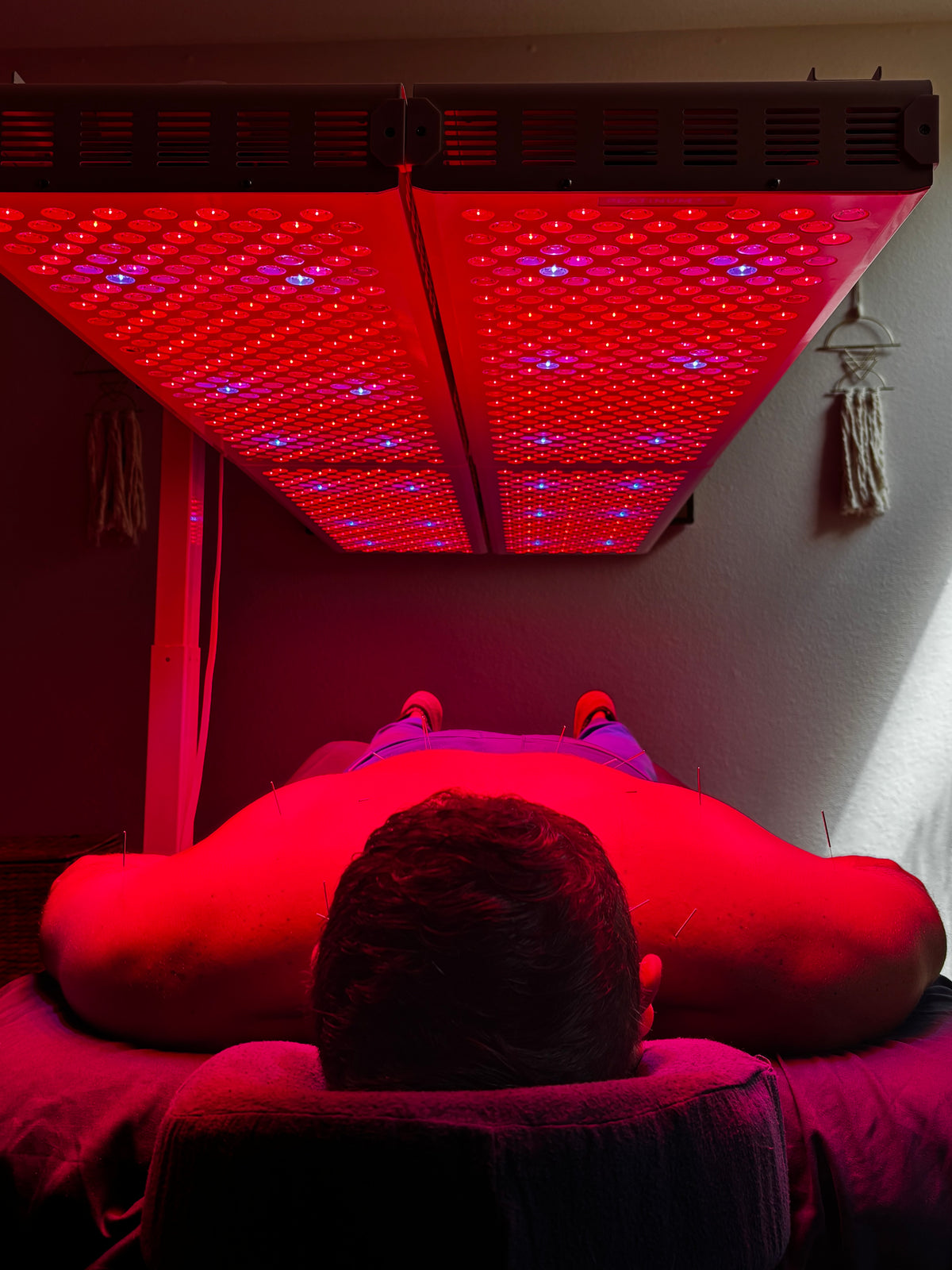 The Solarè Reset $45 - Acupuncture + RLT