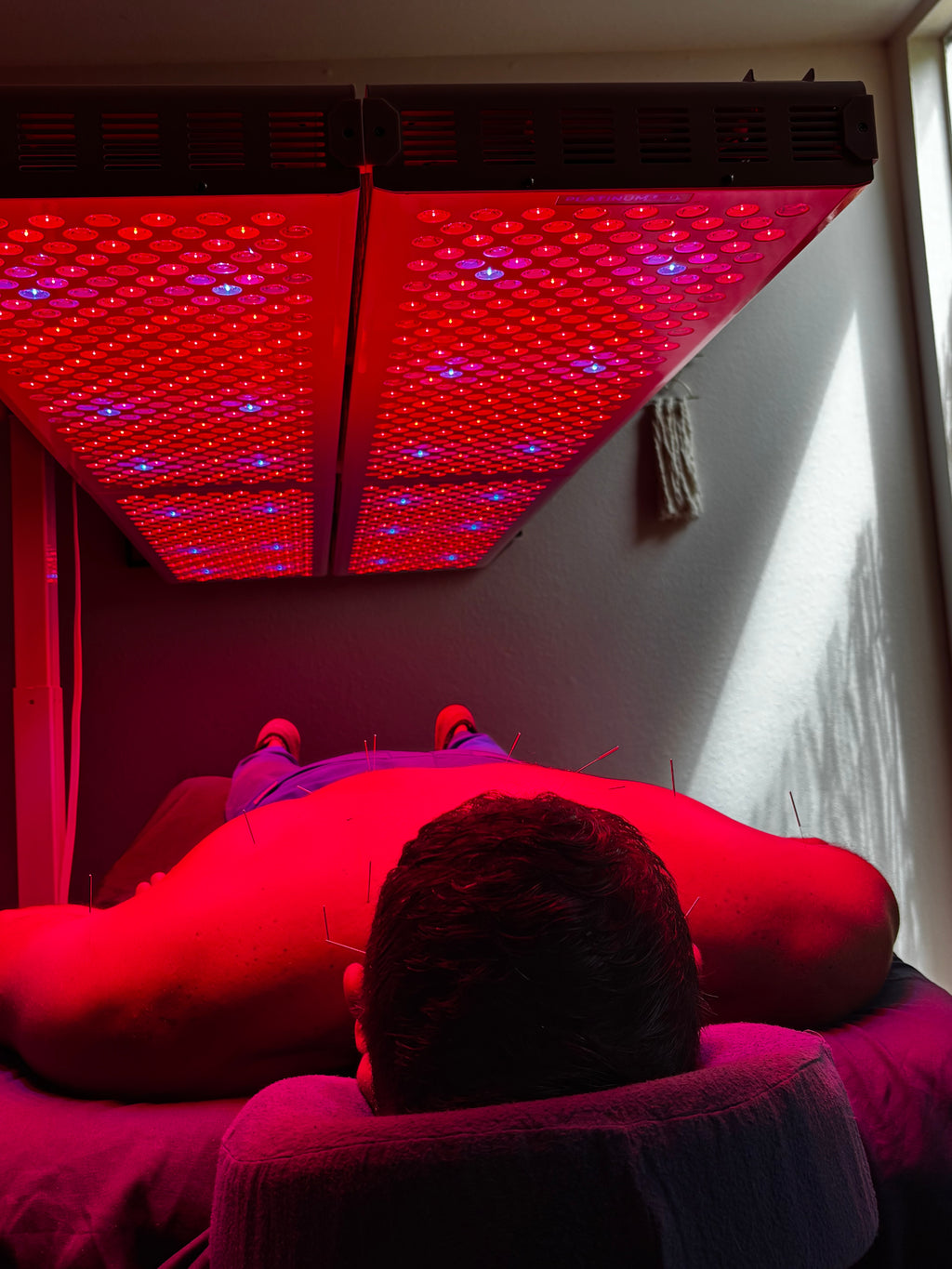 The Solarè Reset $45 - Acupuncture + RLT