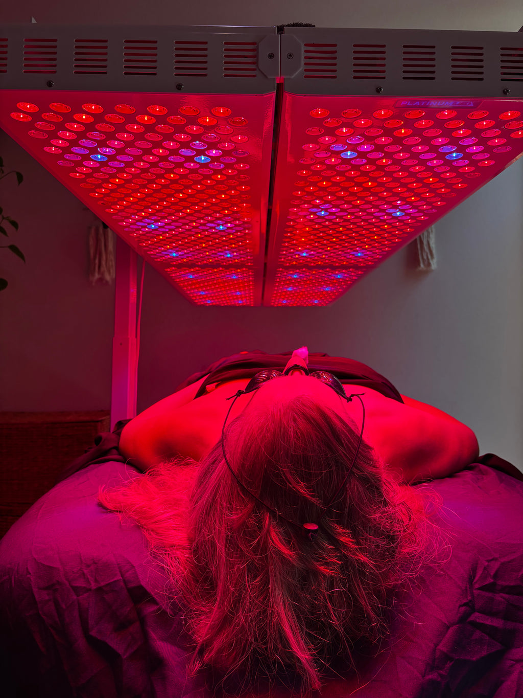 The Solarè Reset $45 - Acupuncture + RLT