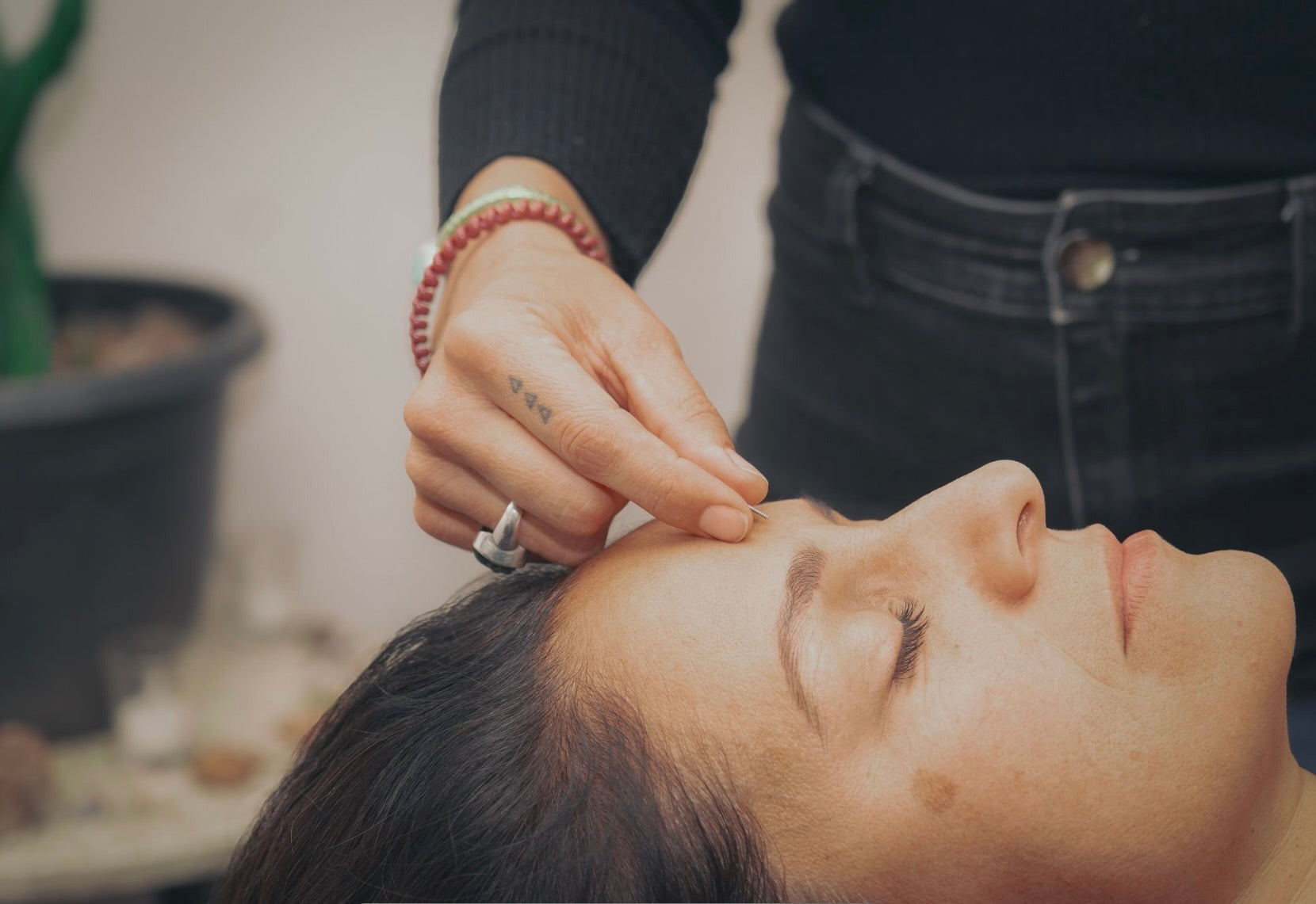Private Acupuncture