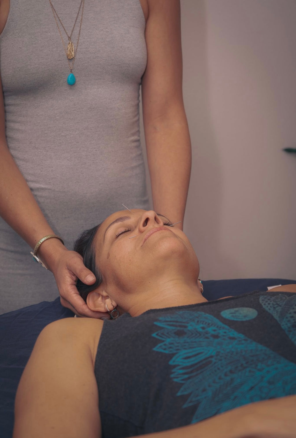 Private Acupuncture