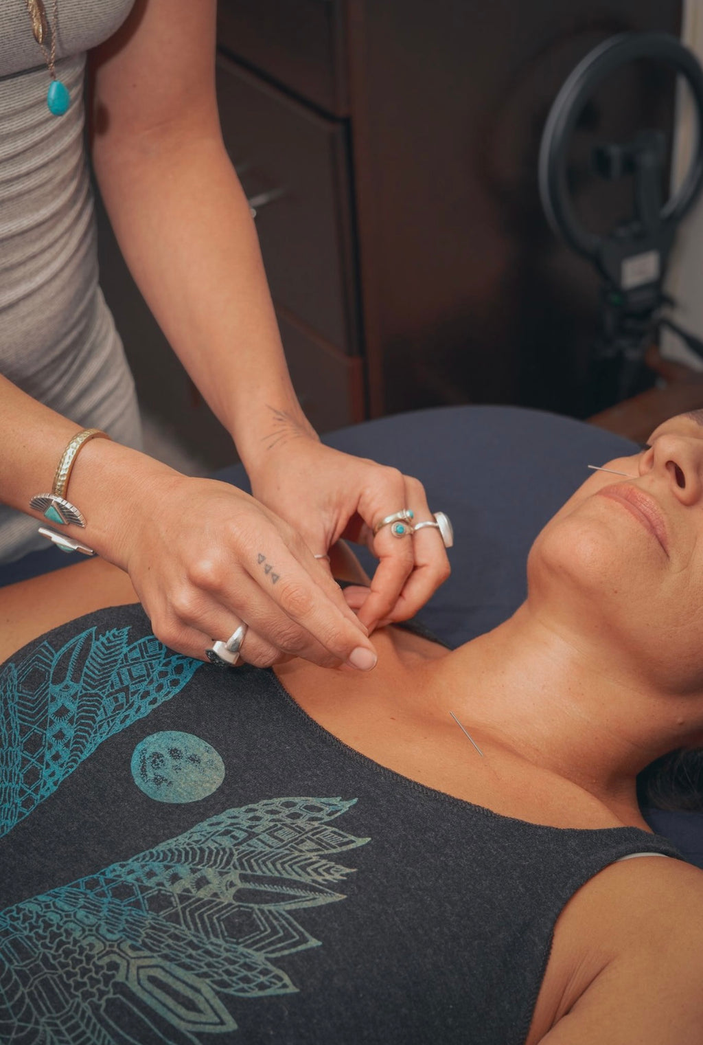 Private Acupuncture