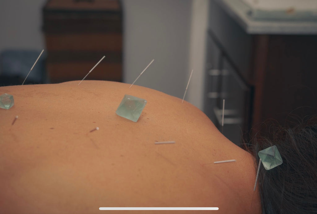 Private Acupuncture