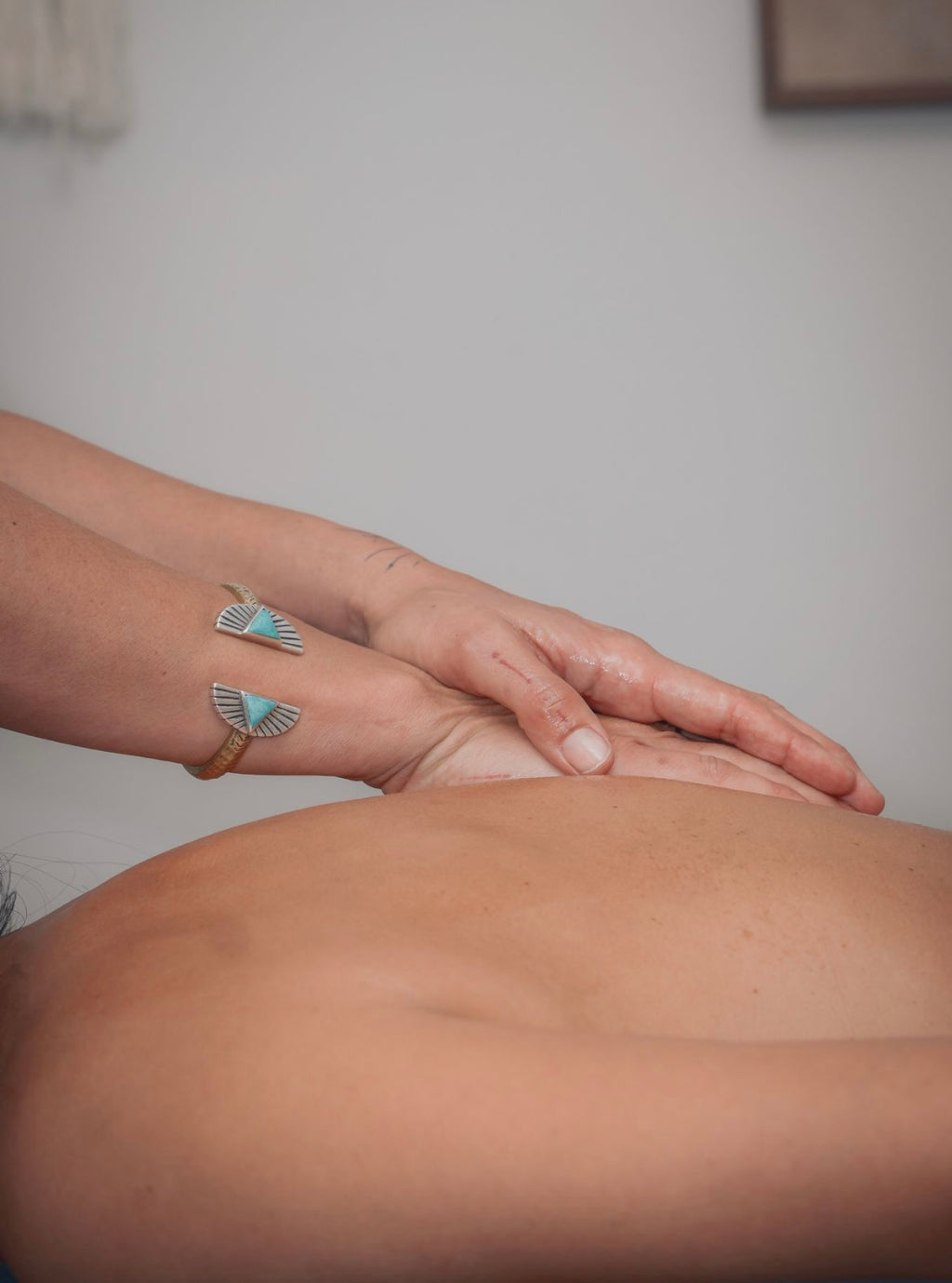 Private Acupuncture